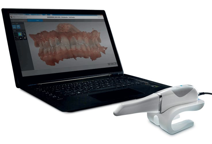 Das Equipment für eine digitale Abformung im Dentalbereich